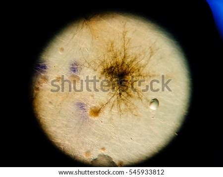 Filamentous Fungi Stock Images, Royalty-Free Images & Vectors ...