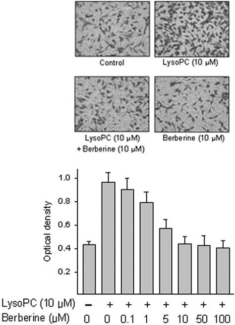 Effect Of Berberine On LysoPC Induced VSMC Migration VSMCs Were