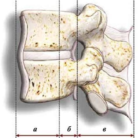 Burst Fractures According To F Denis Classification Download