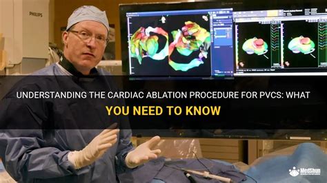 Understanding The Cardiac Ablation Procedure For Pvcs What You Need To