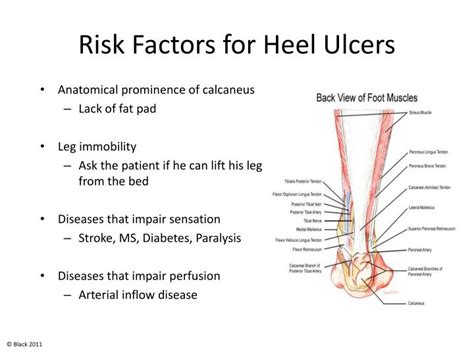 Heel Pressure Ulcer Stages