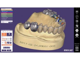 Exocad Ultimate Lab Bundle Gold Quadrat Dental