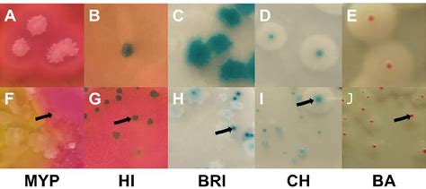 Figure 1 From Performance Testing Of Bacillus Cereus Chromogenic Agar