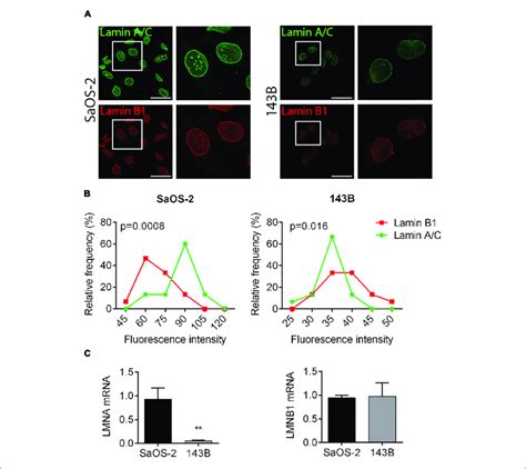 Lamin Ac And B1 Expression In Osteosarcoma Cell Lines With Different