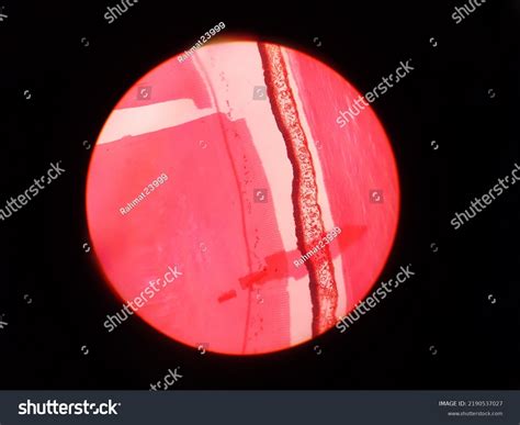 Histology Eye Ear Skin Using Microscope Stock Photo 2190537027 ...