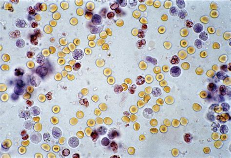examination  urinary sediment veterian key