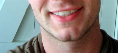 types shapes  chin  comprehensive list mewingcoach