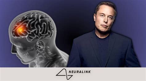 What Are The Pros And Cons Of Elon Musks Brain Chip Neuralink Your Tech Story