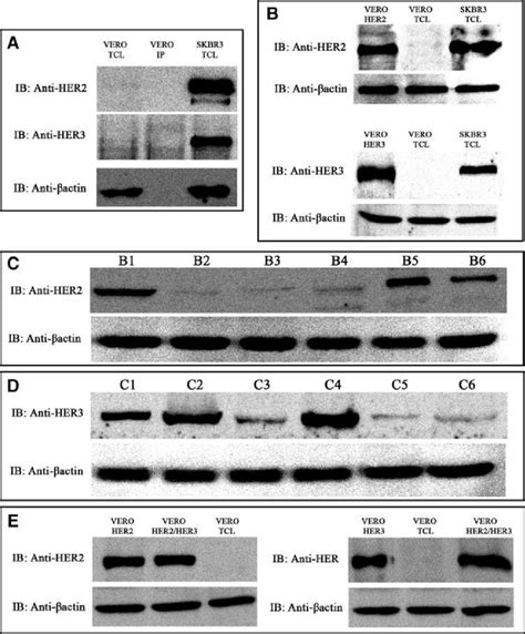 Western Blot Analysis Of Her2 And Her3 Expression In The Transfected