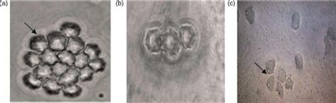 Light Micrograph Of Acanthamoeba Cysts A B And Trophozoite C In Download Scientific