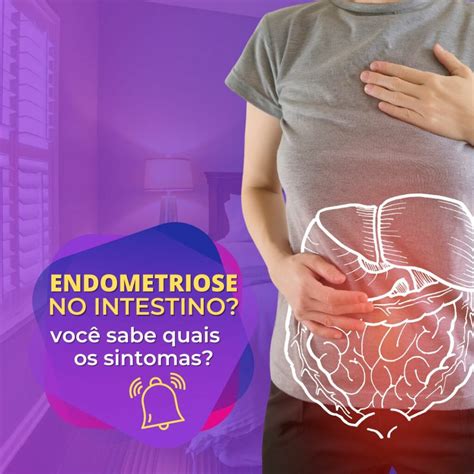 Saiba Quais Os Sintomas Da Endometriose Intestinal Dr Demetrius Germini