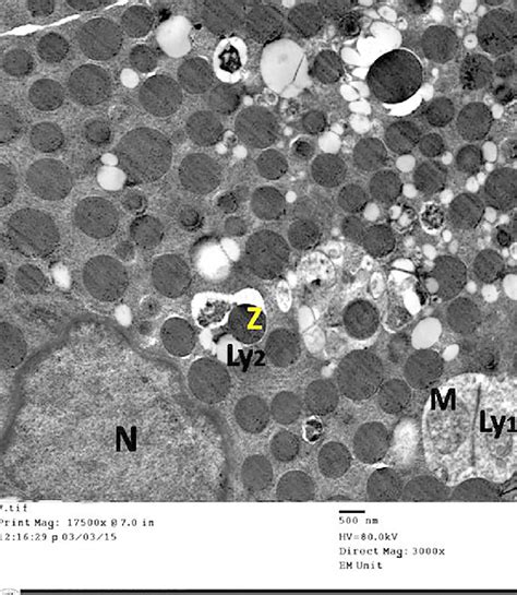 An Electron Micrograph Of An Ultrathin Section From The Exocrine Part