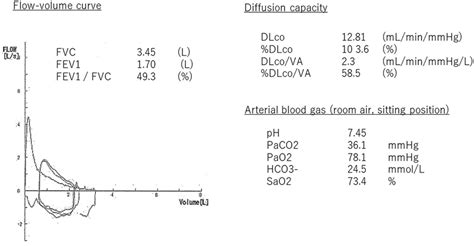 Pulmonary Function Test And Arterial Blood Gas Fvc Was L And Fev