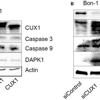 Regulation Of Caspase 3 And 9 And DAPK1 Protein Levels By Western Blot