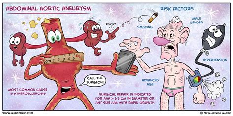 Medcomic Medcomic Twitter Aortic Aneurysm Abdominal Aortic