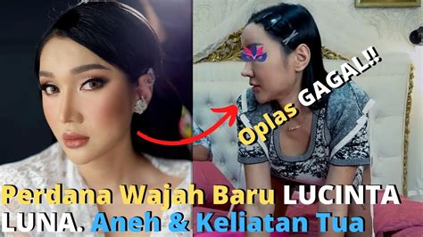 Oplas Gagal Perdana Penampakan Wajah Baru Lucinta Luna Setelah