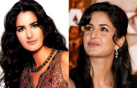 Katrina Kaif Plastic Surgery Before And After Photo Pics Showing Lips