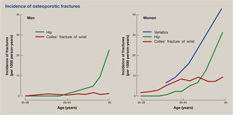 Identification And Management Of Osteoporosis In Older Adults Medicine