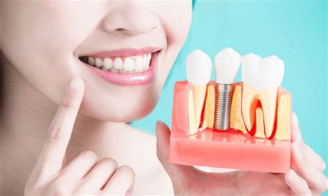 5 Ways Dental Implants Can Improve Your Smile