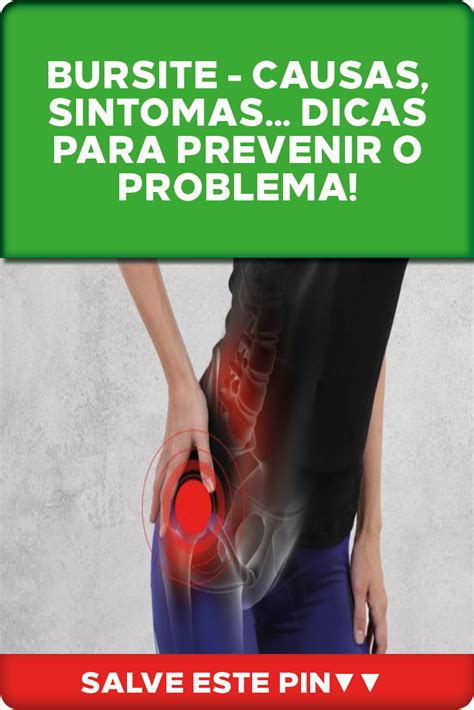 Bursite Causas Sintomas Dicas Para Prevenir O Problema Bursite