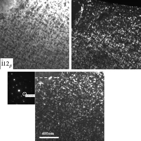 Bright Field And Dark Field Micrographs Showing The Phase