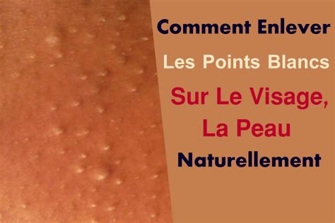 Comment Enlever Les Points Blancs Sur Le Visage La Peau Naturellement