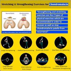 What is Sports Massage Therapy for Chondromalacia Patella? Chondromalacia Patella Exercises ...