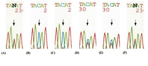 Sequence Chromatograms Of The Xist Locus Amplified From Control And