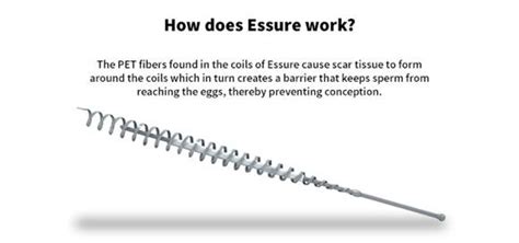 Essure Side Effect Lawyers Toronto | Essure Birth Control Lawsuits Ontario