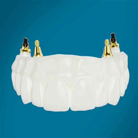 New Nobelprocera Zirconia Implant Bridge Simplifies The Partnership