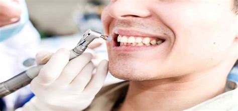 Best Scaling And Polishing Treatment For Teeth Whitening