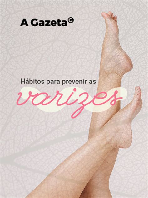 Hábitos para prevenir as varizes