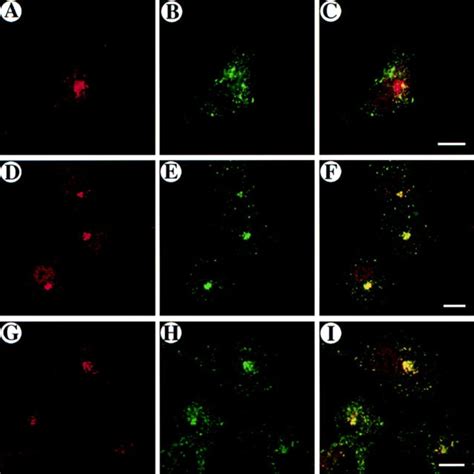 Colocalization Of Rab Wt And Internalized Fitc Labeled Transferrin In