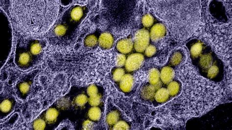 Coronavirus Mehr Als Infizierte In Deutschland Tagesschau De