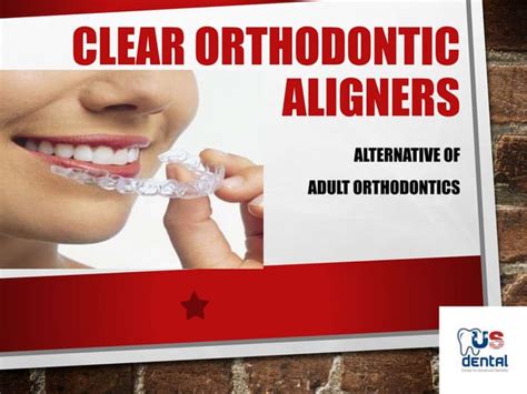 Clear Orthodontic Aligners Ppt