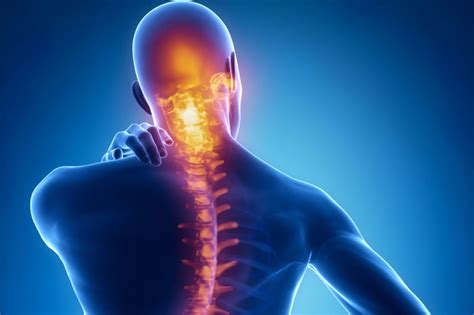 What is Scoliosis? | NeuroSpine Surgical Consultants