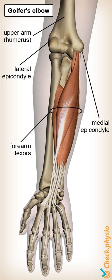 Golfers Elbow Physio Check