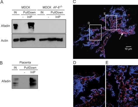 Listeria Monocytogenes Inlp Interacts With Afadin And Facilitates