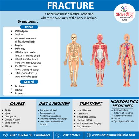 Fracture – SHATAYU MULTI-SPECIALITY CLINIC