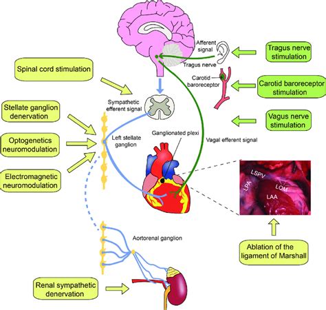 Cardiac Autonomic Innervation And Neuromodulation Strategies LPA