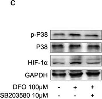 HIF 1 Alpha Antibody BSA Free NB100 479 Bio Techne