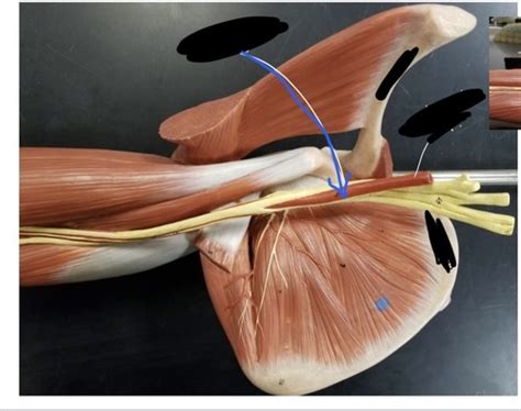 Arteries Of The Arms Models Flashcards Quizlet