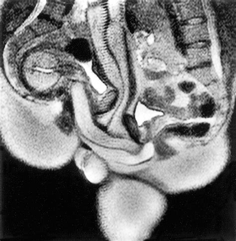 Fig 3 The Bmj