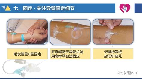 【ppt】静脉留置针的应用与维护护士输液药物患者 健康界