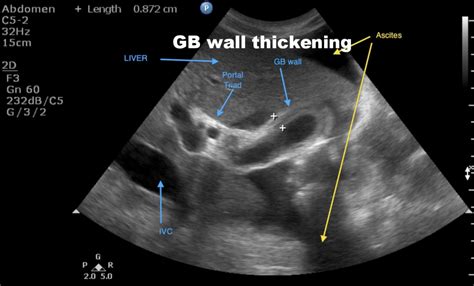 Biliary — Nuem Blog