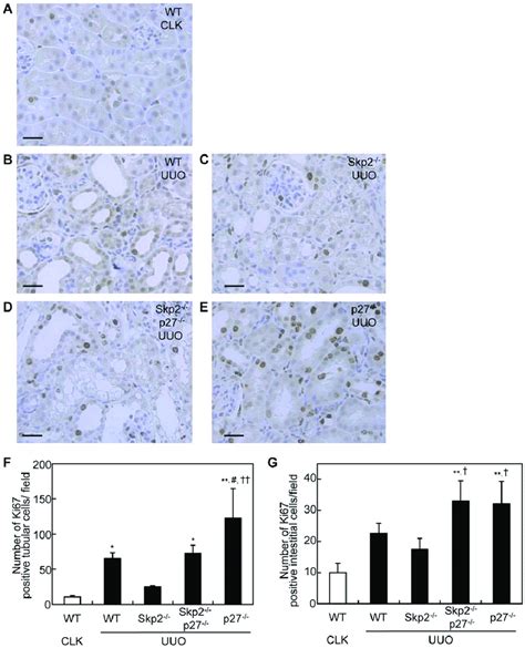 Numbers Of Ki67 Positive Proliferative Tubular Epithelial And