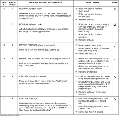 PEDS Unit 3 Exam Eval Flashcards Quizlet