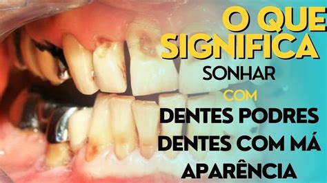 Você sonhar que você tem dentes podres ou dentes má aparência o que