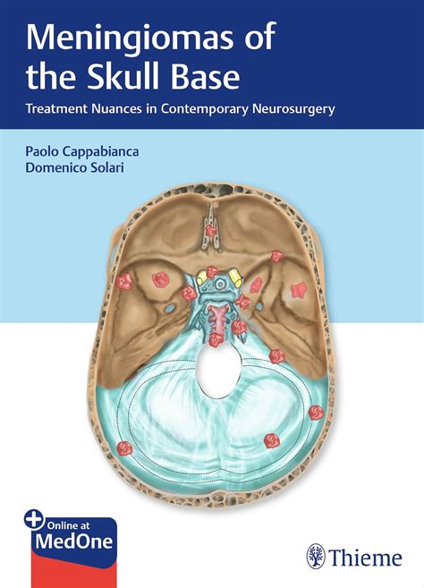 Meningiomas Of The Skull Base Thieme Webshop