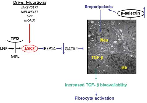 Primary Myelofibrosis